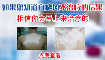 皮肤白斑病因